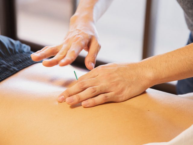 Acupuncture in Newmarket