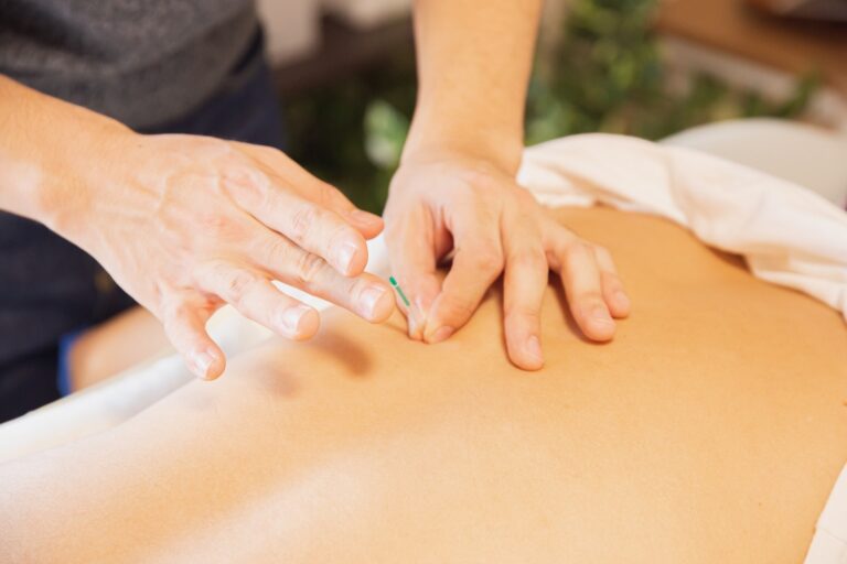 Will Acupuncture Help Sciatica?