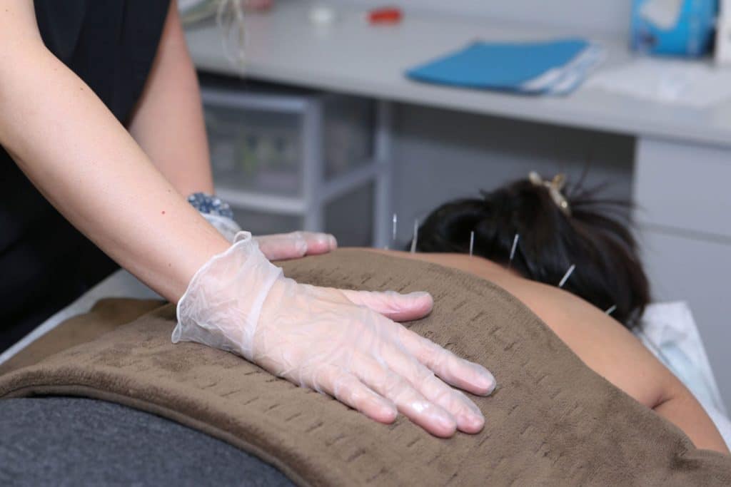 acupuncture benefits