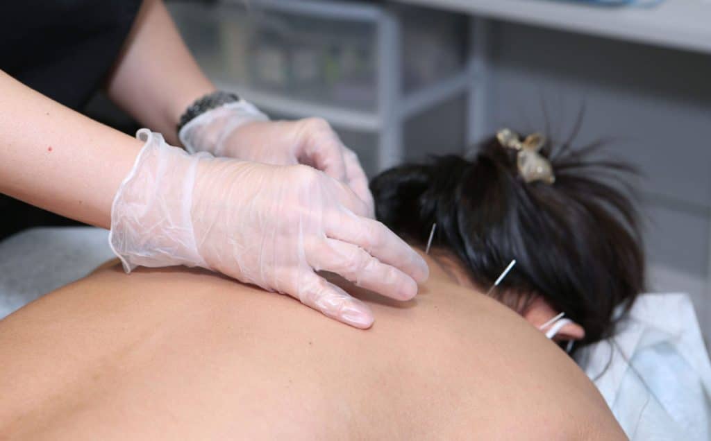 careful removal of acupuncture needles